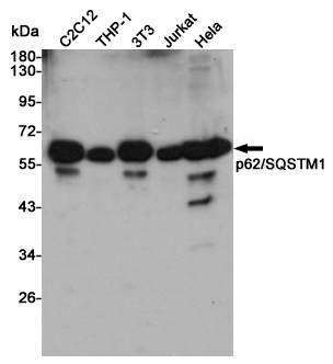 SQSTM1/p62 Rabbit mAb ABZ4891
