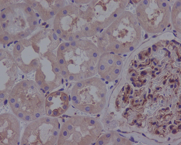 ROCK1 Rabbit mAb ABZ4892