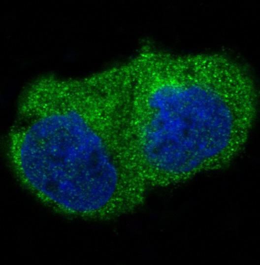ILK Rabbit mAb ABZ4894