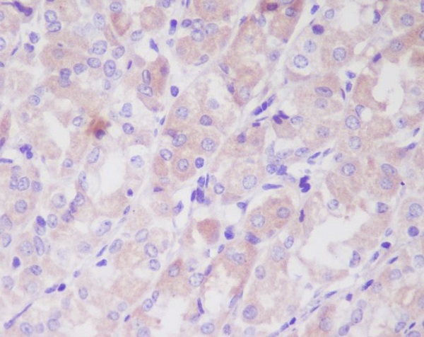 ILK Rabbit mAb ABZ4894