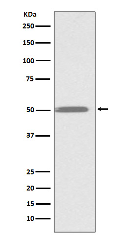 ILK Rabbit mAb ABZ4894