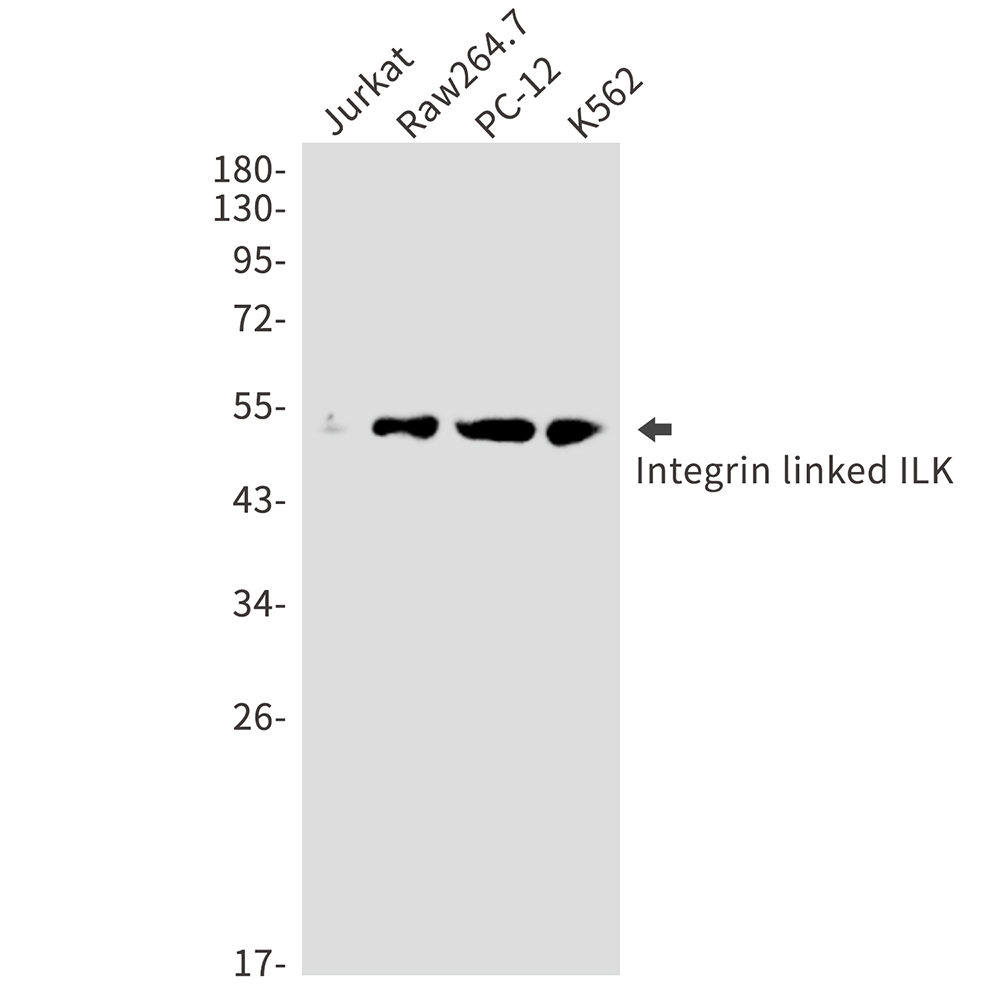 ILK Rabbit mAb ABZ4895