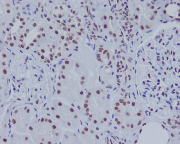 ASH2L Rabbit mAb ABZ4896