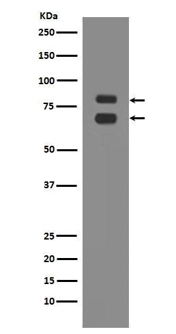 ASH2L Rabbit mAb ABZ4896