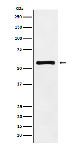 PAK2 Rabbit mAb ABZ4898
