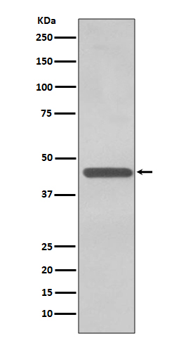 TDP43 Rabbit mAb ABZ4899