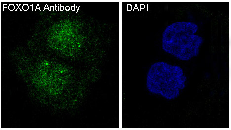 FOXO1 Rabbit mAb ABZ4900