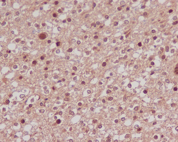 FOXO1 Rabbit mAb ABZ4900