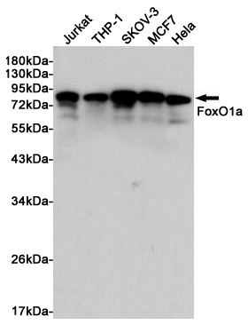 FOXO1 Rabbit mAb ABZ4900