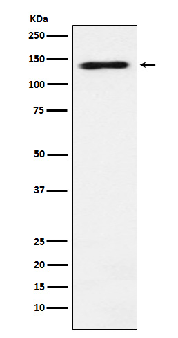 RNA Helicase A Rabbit mAb ABZ4902