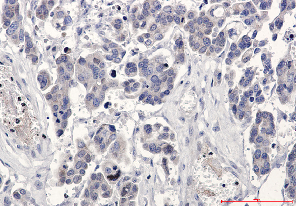 Bcl-XL Rabbit mAb ABZ4903