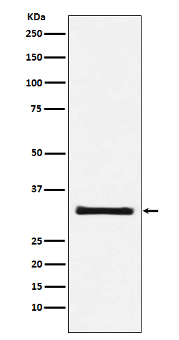 GC1q R Rabbit mAb ABZ4904