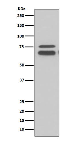 FMRP Rabbit mAb ABZ4905