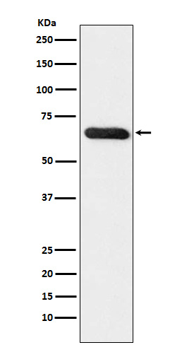 RBPJK Rabbit mAb ABZ4906
