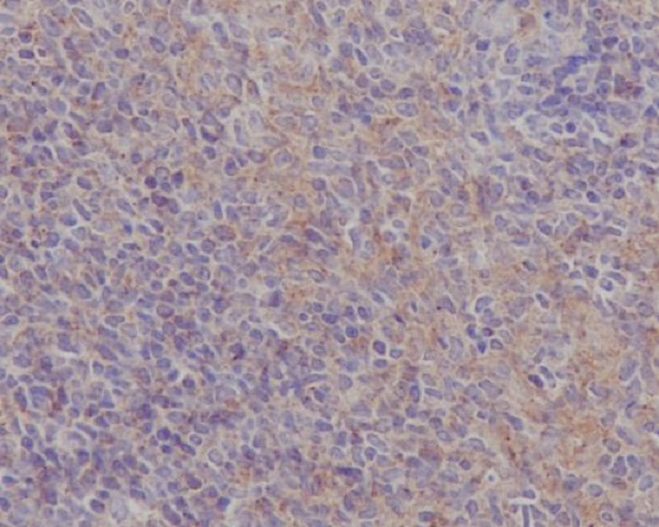 FAK Rabbit mAb ABZ4907