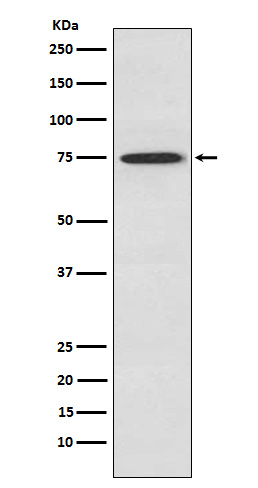PKC theta Rabbit mAb ABZ4908