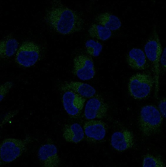 NF-KB p65 Rabbit mAb ABZ4909