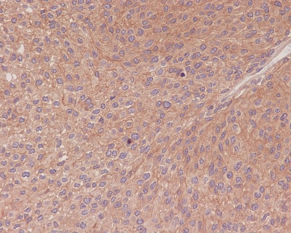NF-KB p65 Rabbit mAb ABZ4909