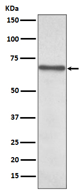 NF-KB p65 Rabbit mAb ABZ4909