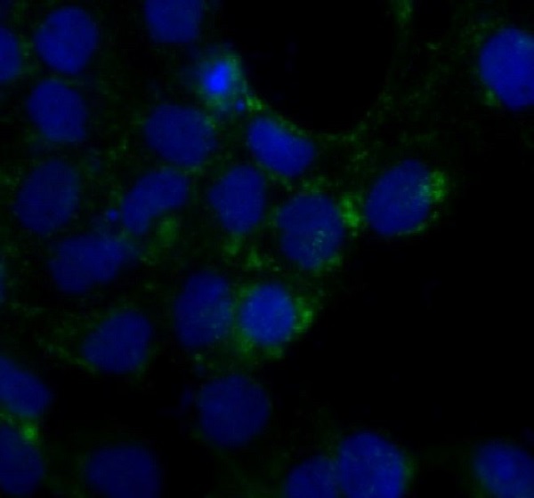 Caveolin-1 Rabbit mAb ABZ4910