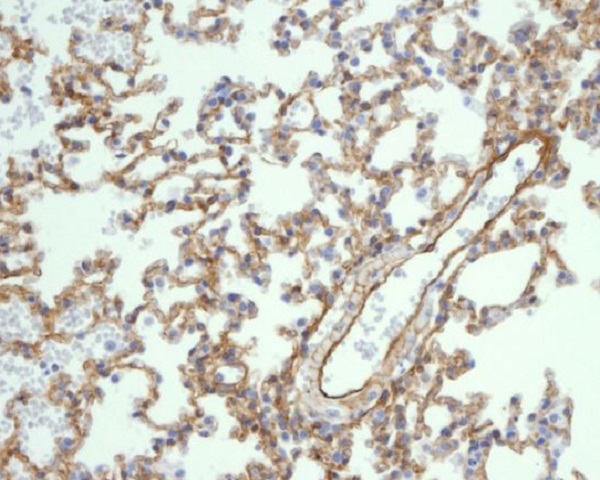 Caveolin-1 Rabbit mAb ABZ4910