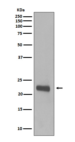 Caveolin-1 Rabbit mAb ABZ4910