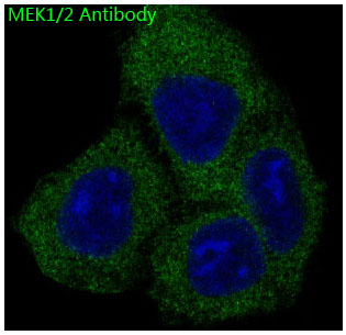 MEK1/2 Rabbit mAb ABZ4911