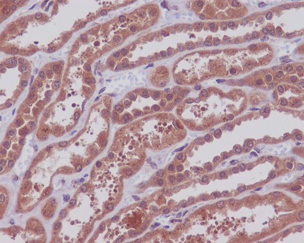 MEK1/2 Rabbit mAb ABZ4911