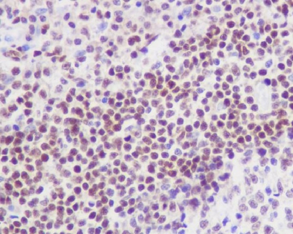 FLI1 Rabbit mAb ABZ4913