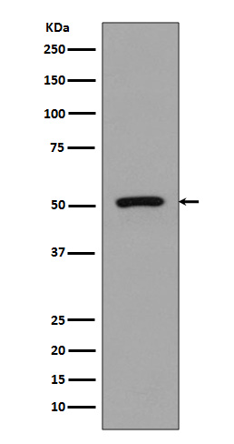 FLI1 Rabbit mAb ABZ4913