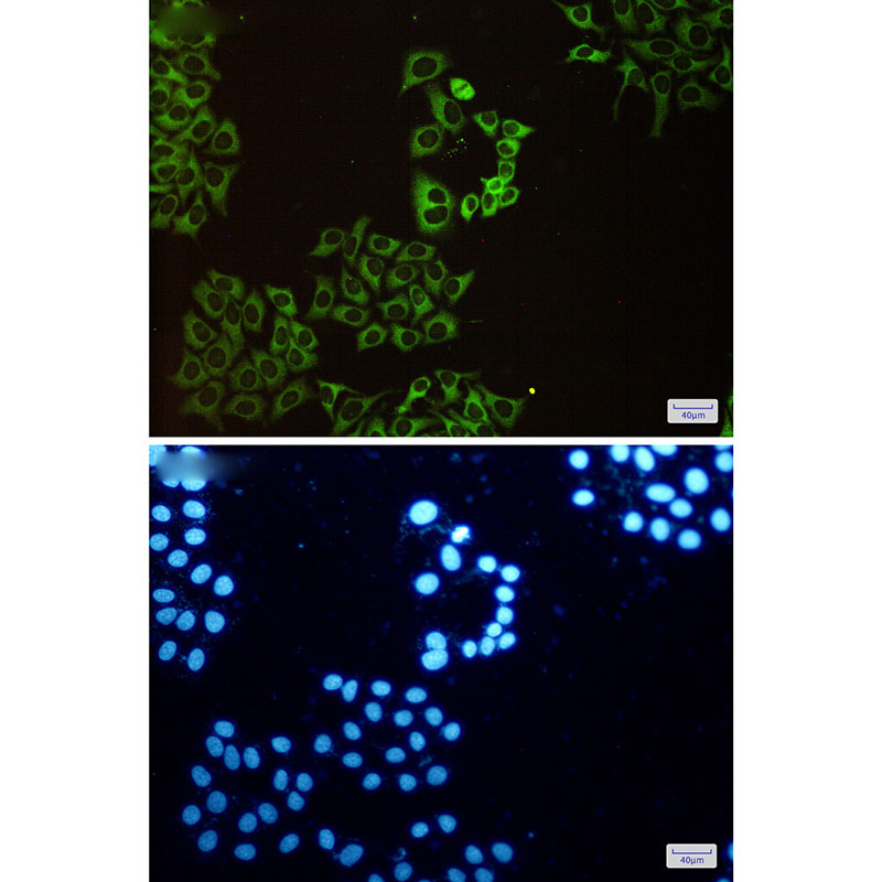 CAP1 Rabbit mAb ABZ4914