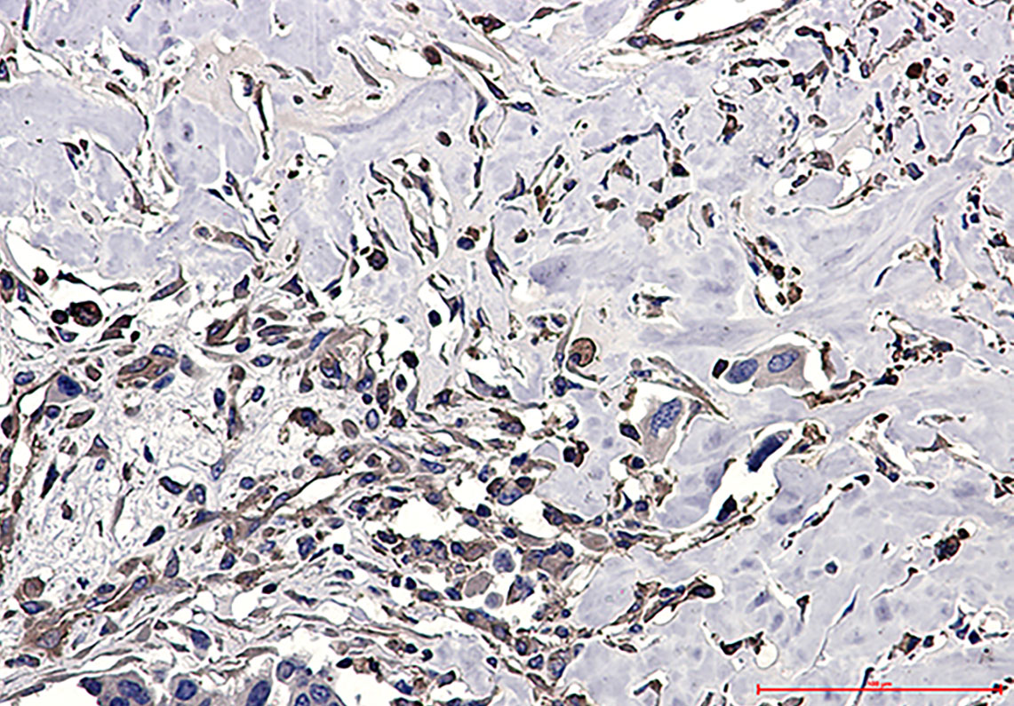 CAP1 Rabbit mAb ABZ4914