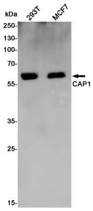 CAP1 Rabbit mAb ABZ4914