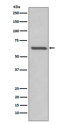 Rel B Rabbit mAb ABZ4915