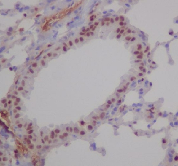 RUNX1/2/3 Rabbit mAb ABZ4916