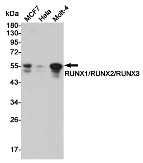 RUNX1/2/3 Rabbit mAb ABZ4916