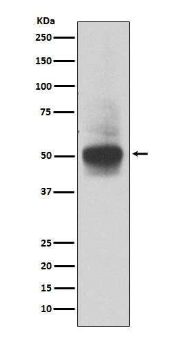 RUNX1/2/3 Rabbit mAb ABZ4916