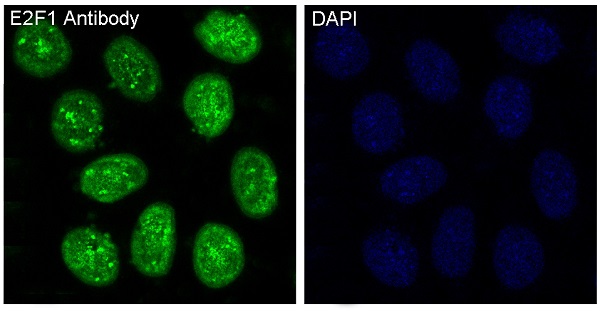E2F1 Rabbit mAb ABZ4918