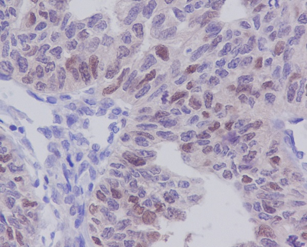 E2F1 Rabbit mAb ABZ4918