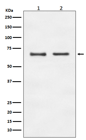 E2F1 Rabbit mAb ABZ4918