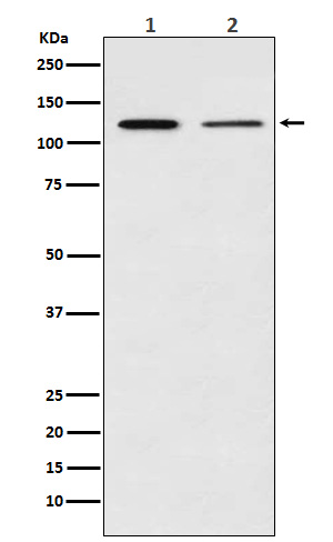 NF-KB p100 Rabbit mAb ABZ4919