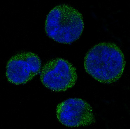 CDK6 Rabbit mAb ABZ4920