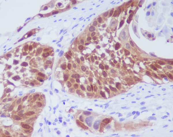 CDK6 Rabbit mAb ABZ4920