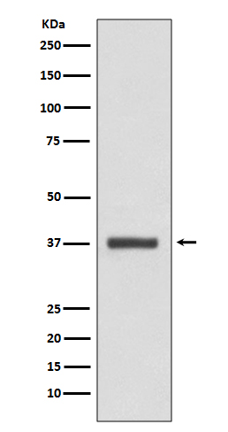 CDK6 Rabbit mAb ABZ4920