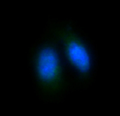 FOXO4 Rabbit mAb ABZ4922