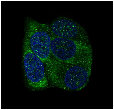 YB1 Rabbit mAb ABZ4923
