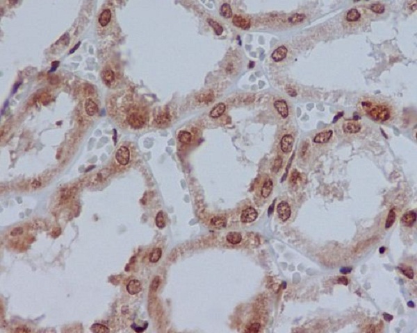 YB1 Rabbit mAb ABZ4923
