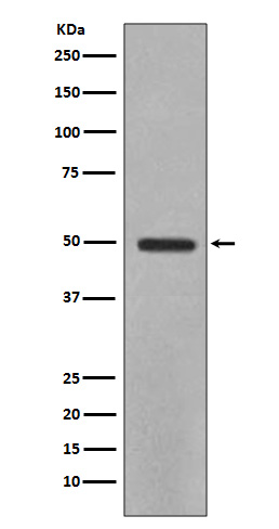 YB1 Rabbit mAb ABZ4923