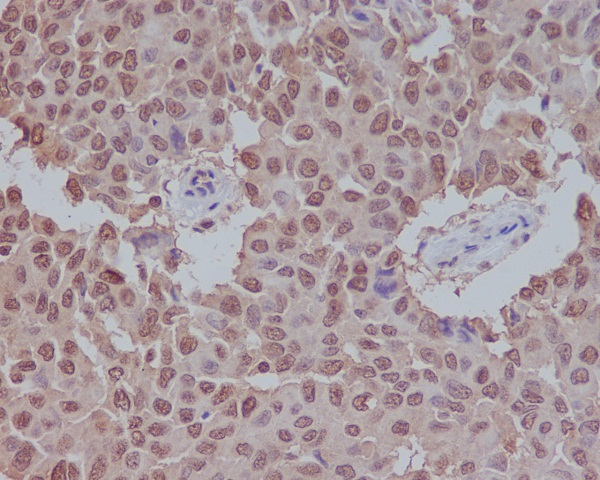 SUMO1 Rabbit mAb ABZ4924
