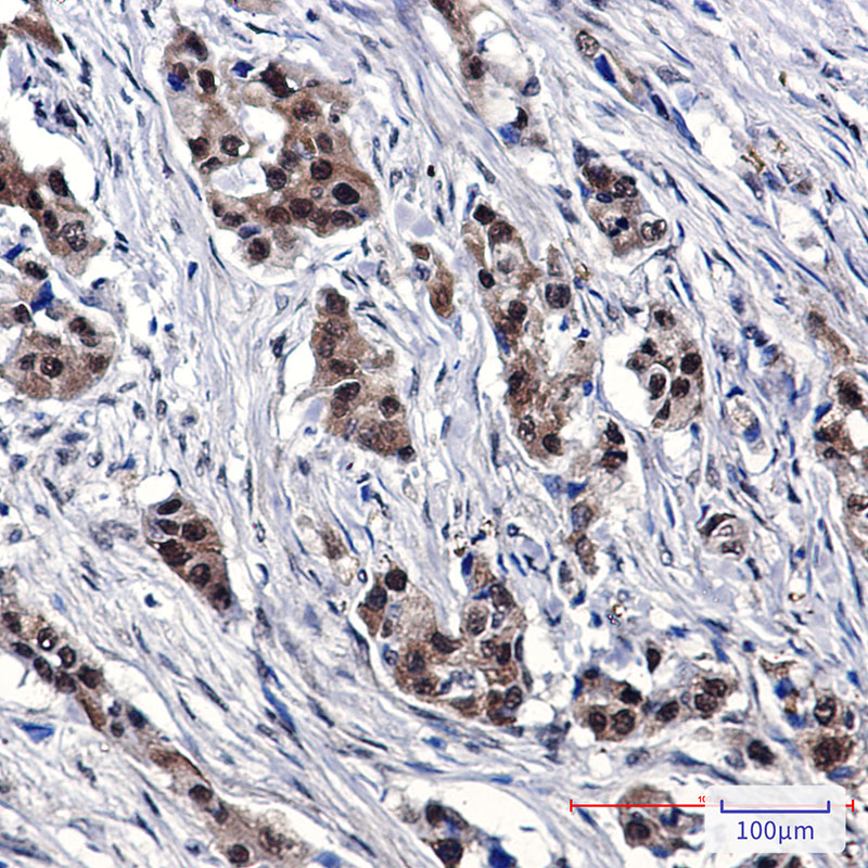 SUMO1 Rabbit mAb ABZ4925